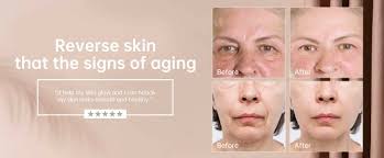 LED Light Therapy Facial Mask