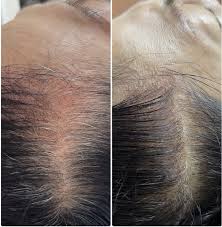 髪頭皮改善 | 横浜青葉台シミ毛穴たるみ改善専門のエステ美キュート