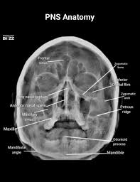 Image result for Sinus X Ray