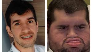 Fundraiser for Patricia Alves Machado by MARLA RABELLO : Ajudem Vilma e  Laerte nesse luta