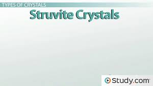 We did not find results for: Crystals In Urine Meaning And Causes Video Lesson Transcript Study Com