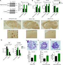 Cara investasi emas saat harga turun. A Non Mosaic Transchromosomic Mouse Model Of Down Syndrome Carrying The Long Arm Of Human Chromosome 21 Elife