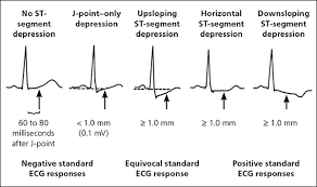 Practice with over 200 electrocardiogram strips as well as factual guidelines for our philosophy is that the skill and efficiency of electrocardiogram (ecg) interpretation come with. Exercise Stress Testing Indications And Common Questions American Family Physician