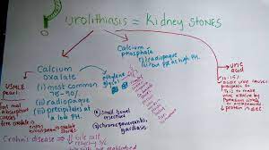 Dr Zee Usmle Step 2ck Lectures Nephrology Urolithiasis Youtube