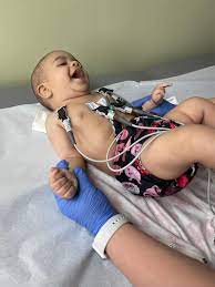 Anyone also has a baby with a congenital heart defect? How are you hanging on? - March 2023 Babies | Forums | What to Expect