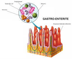 Gastro Enterite Contagion Duree Symptomes Traitement