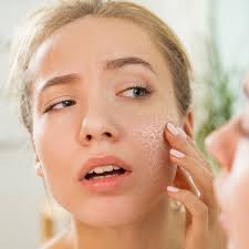 Image result for Dry Skin