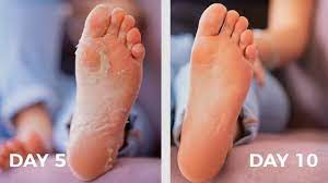 1 Amazon Finds Tiktok The Best Foot Peeling Mask Plantifique Skincare Youtube