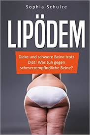 Amazon Com Lipodem Dicke Und Schwere Beine Trotz Diat Was Tun Gegen Schmerzempfindliche Beine German Edition 9781980924715 Schulze Sophia Books