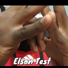 Image result for Elson Extensor Tendon Test