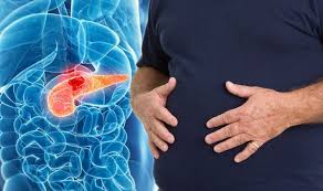 Initially doctors may suspect pancreatitis, a i had some stomach pains, when i ate, i used to get a reaction about half an hour after i ate, which again everyone thought was the food going down. Pancreatic Cancer Symptoms Signs Include Pain In Stomach Area Express Co Uk