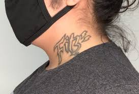 The fresh start tattoo removal program, inc. We Give Back To Our Community Removery