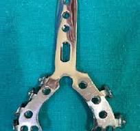 Designing of a Distal Humerus Anatomical Biplanar Locking ...