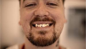 How tacos helped Broke Boy chef break addiction: 'I obsessed over it'