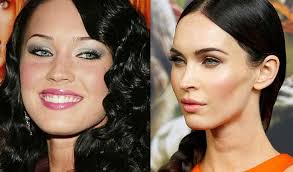 Depois dessas fotos bichectomia antes e depois, agora é com você. Antes E Depois Da Bichectomia Veja Como Ficaram Os Famosos Que Fizeram A Cirurgia Alto Astral