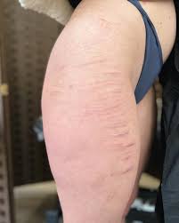 Nancy Fine Line Watercolor Tattoo | Scar cover up for her！ | Instagram