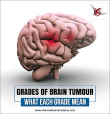 We All Know Brain Tumour Occurs When There Is Abnormal Growth Of Cells On The Brain A Brain Tumour Can Be Prima Abnormal Cell Growth Brain Tumor Spine Surgery