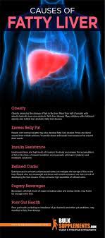 Fatty Liver Disease Symptoms Causes Treatment