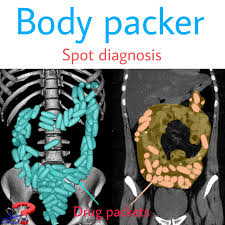 Image result for Body Stuffer