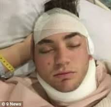 Australian tourist returns home after Bali motorbike crash