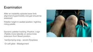Image result for Patella Tracking Assessment