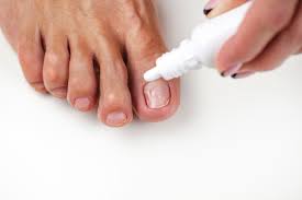 Image result for mykoza nehtů