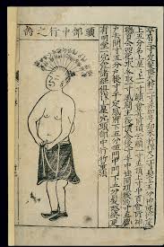 file acupuncture chart midline of the head chinese woodcut