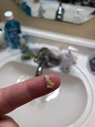 You are allergic to any ingredient in debrox solution. I Flushed Out My Ears With Debrox This Literally Popped Out Of My Left Ear I Actually Heard My Ear Pop Felt Instant Relief Popping