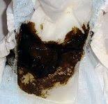 Stuhlgang Und Urin Eines Neugeborenen Gestillten Babys Still Lexikon