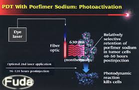 Image result for Porfimer