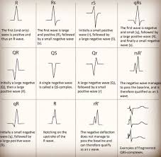 Medical Doctors And Students On Instagram Different Morphologies Of P Waves In Various Pathologies Credits Doctord Medizinstudium Medizin Studium