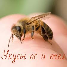 ukusy os i pchel reakcii ot ukusov mogut byt 1 obshimi anafilakticheskij shok bronhospazm otek lica odyshka sinushnyust poterya soznaniya pchela lico odyshka