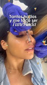 ✨ Por supuesto que soy un hada..., ¡Y soy el hada tuneada! 💉🪄, Mi hada  favorita soy yo misma,, pero lo mejor de todo…, son las manos mágicas de la  Dra. K., 🧚‍♀️ Porque en sus manos, hasta las hadas se ...