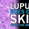 Most of the time purpura will go away on their own within a few weeks or months. 1