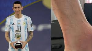 En la toma se puede ver que el futbolista ya está sobre el auto para irse al encuentro que tendrán los chunchos esta tarde frente a deportes antofagasta. Asi Siguio Jugando Esposa Mostro El Tobillo De Angel Di Maria Tras La Final De Copa America Alairelibre Cl