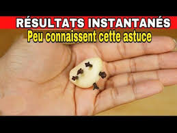 Vous Allez Vouloir Mettre 5 Clou De Girofle Dans 1 Gousse D Ail Quand Clou De Girofle Girofle Gousse D Ail
