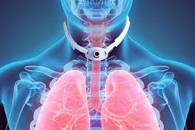 Image result for Tracheostomy