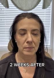 Melissa Medspa Consultation