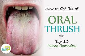 Feat Hoe To Get Rid Of Oral Thrush Remedies For Dry Mouth Top 10 Home Remedies Tongue Health