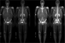 Image result for full body scan