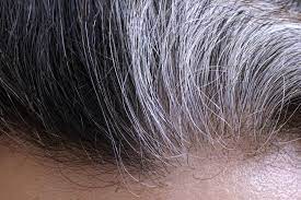 When i say ageing that doesn't precisely give you a number or a threshold, which is quite annoying. Causes Of Baldness Gray Hair Identified