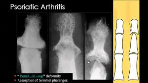 Dr Abuaiad Adli Kullanicinin Bone And Joints Panosundaki Pin Okuma