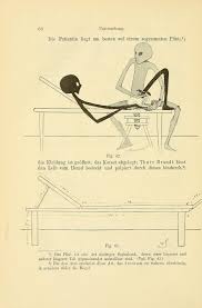 Gynaecology For Women And Other Aliens Thure Brandt S Digital Gymnastics 1895 Flashbak Gynecology Gymnastics Books Magazines