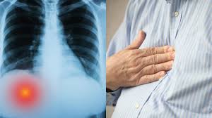 What organ is located is middle of chest under end of rib cage? Here S What It Means If You Have Pain Under You Right Rib Cage