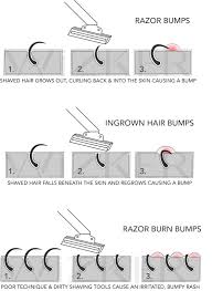 There are a few ways you can exfoliate, but exfoliation via acids (like glycolic, salicylic, and lactic) is the easiest and fastest route. 3 Types Of Shaving Bumps 1 Razor Bumps 2 Ingrown Hairs 3 Razor Burn Bumps Www Wizker Com Ingrown Hair Ingrown Hair Bump Ingrown Hair Armpit