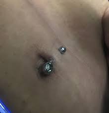 Peeling Skin Around Bottom Hole Of Navel Piercing What Does It Mean More Details In Comments Piercingadvice