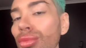 David Kosir želi biti 'ljudski Ken': Ulupao je bogatstvo u plastične  operacije i još nije gotov