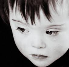 Woche und medikamentös bis zur 8. Down Syndrom Neun Von Zehn Frauen Lassen Baby Dann Abtreiben Welt
