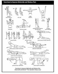 I looked the term up and it happens that a dowager is somebody like violet crawley — lady grantham in downton abbey. What Is A Dowager S Hump Can It Be Reversed What Is Kyphoplasty Would It Help My Spinal Fractures 100 Questions Answers About Osteoporosis And Osteopenia
