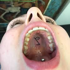 Is mouth herpes contagious, symptoms of mouth herpes, signs, early signs, pictures,photos often parents will simply consider them a normal nuisance part of childhood. This Tattoo Artist Uses Unconventional Body Parts As His Canvas Here Are His 23 Secret Tattoos On The Roof Of The Mouth Bored Panda